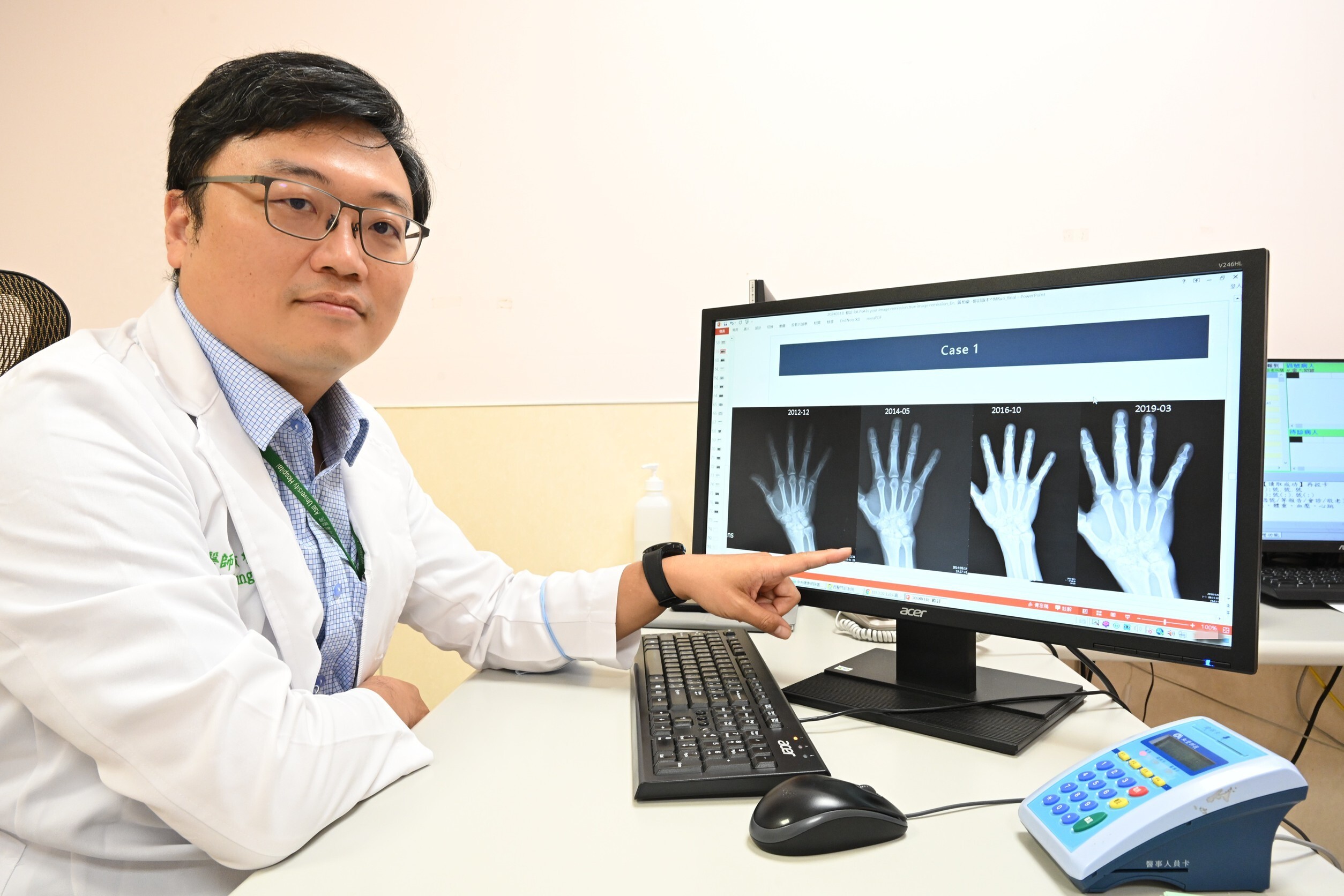 廚師誤解類風濕關節炎:不痛不代表沒事,醫師提醒定期檢查重要性