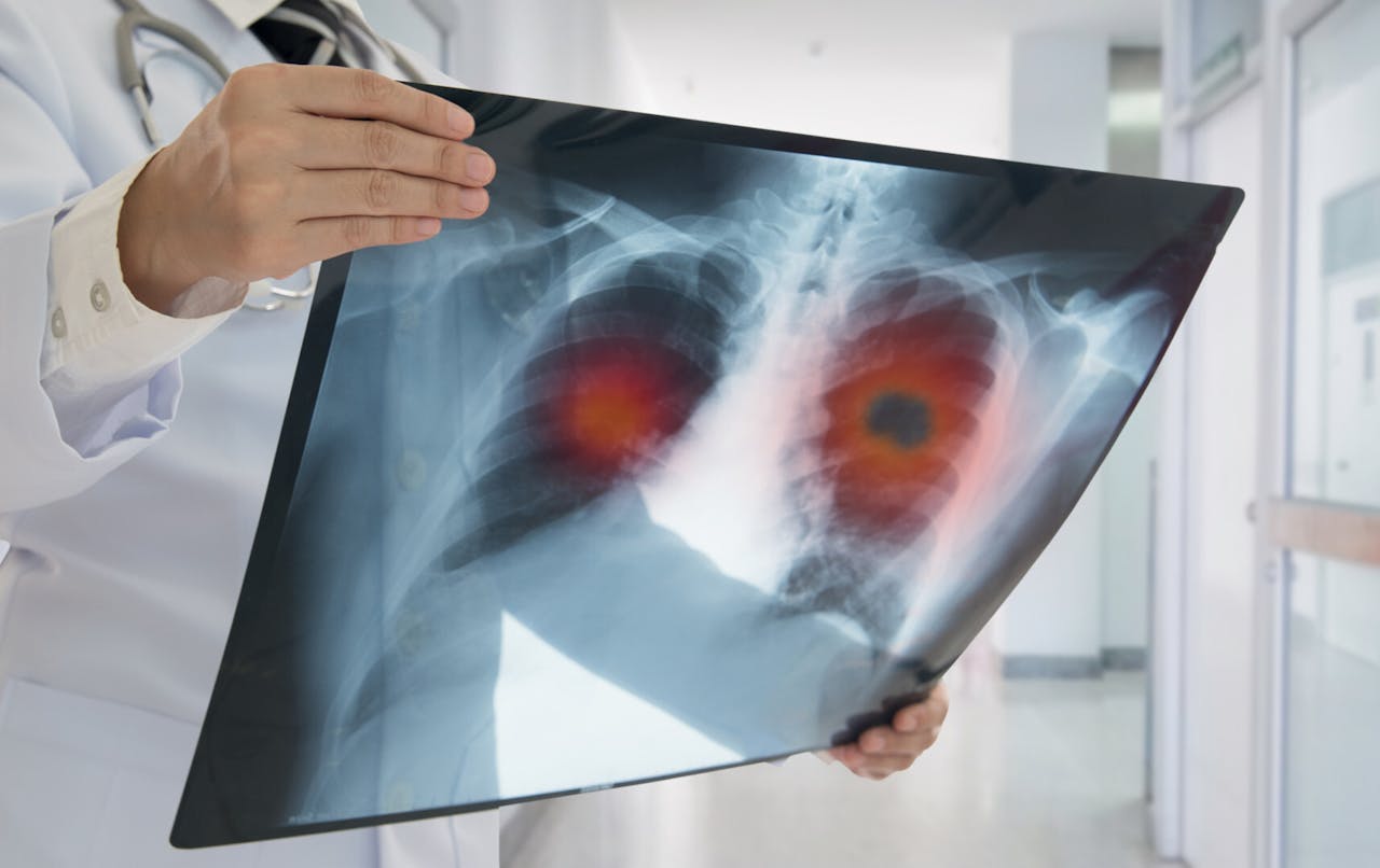 所謂「癌症」，並非單指某一個疾病，而是一類病的統稱。（Shutterstock）