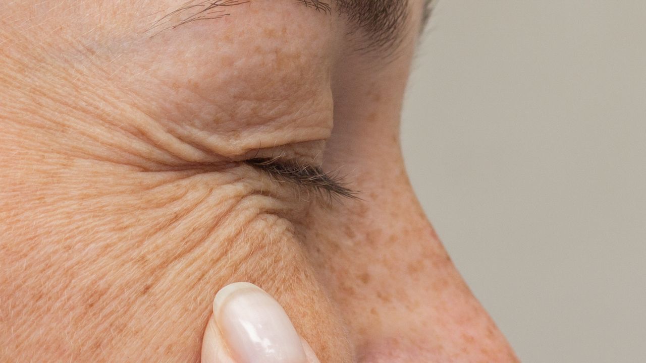 《香港粵語大詞典》「打褶」條︰「皮膚產生皺紋」。（Shutterstock）