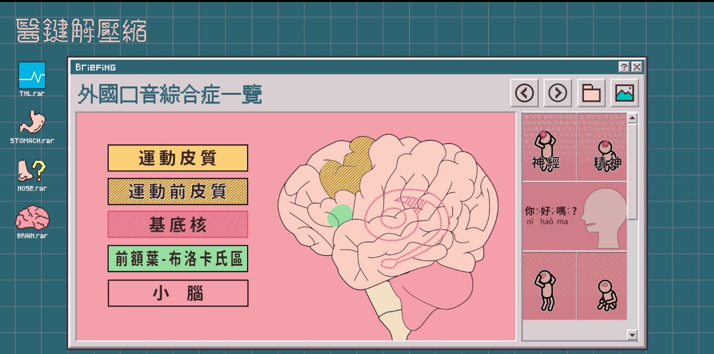 醫鍵解壓縮】S1EP03｜全球只有100多例，外國口音綜合症究竟是