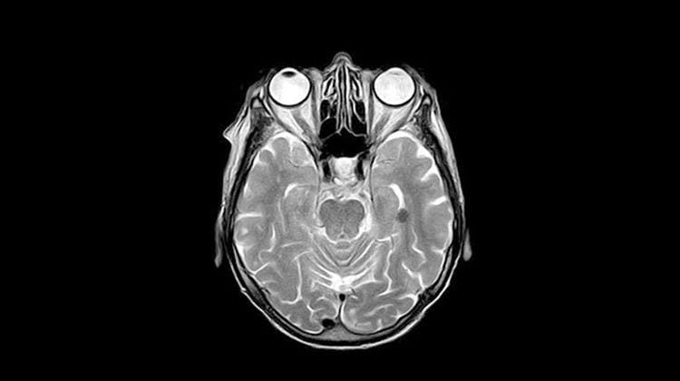MRI