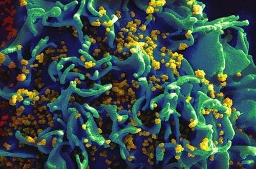 是除了何大一博士的成果外，這裡還有其他值得大家關注的 HIV 治療訊息這篇文章的首圖