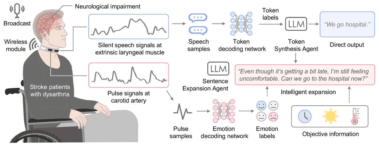智慧項圈結合AI 助中風患者重新開口