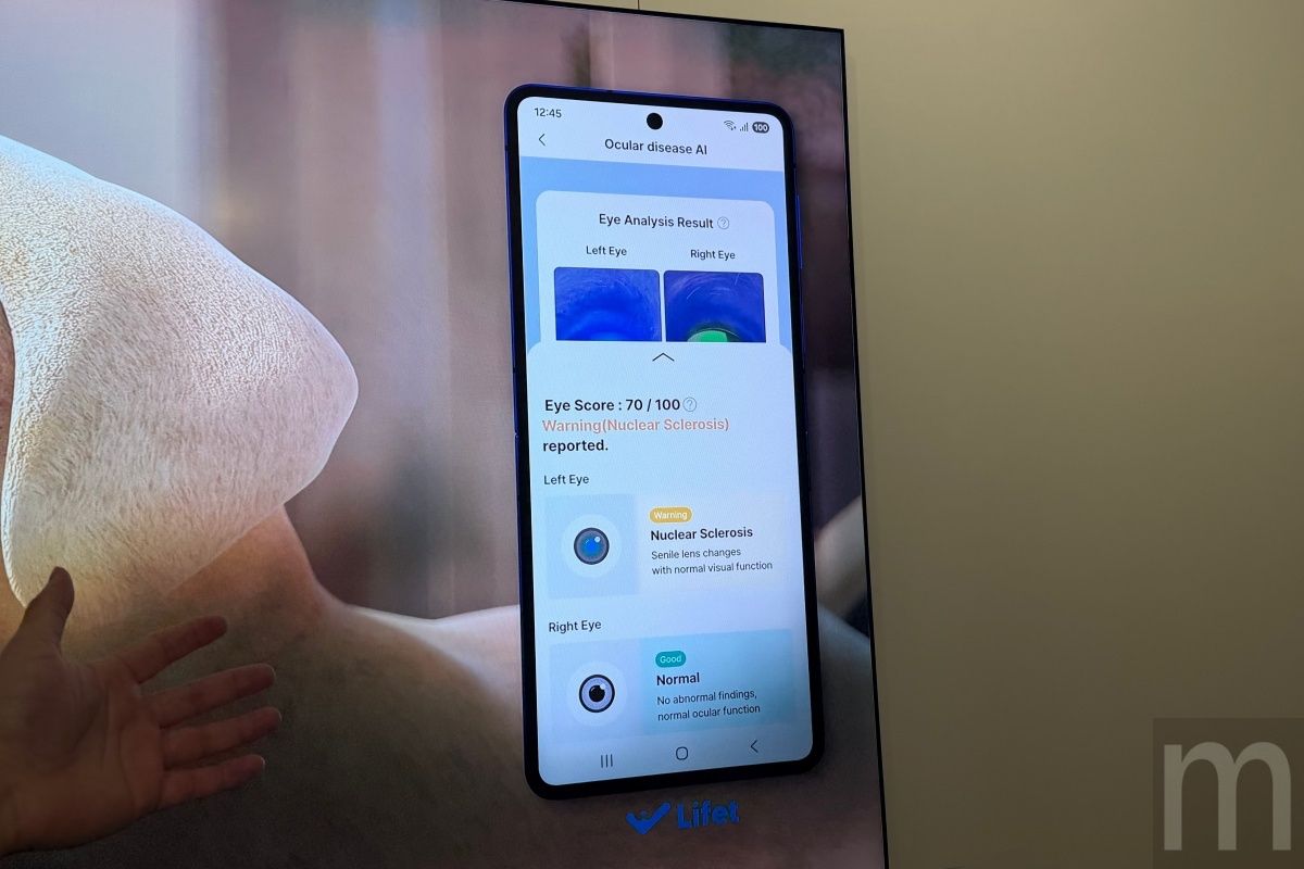 三星利用Galaxy AI協助判斷家中貓、狗身體狀況,透過手機拍攝即可判斷