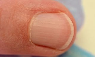 Ongle_du_doigt_de_la_main_-_Fingernail_h