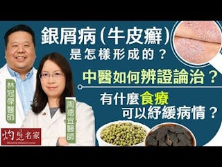 林冠傑醫師x周德宜醫師：銀屑病（牛皮癬）是怎樣形成的？ 中醫如何辨證論治？有什麼食療可以紓緩病情？