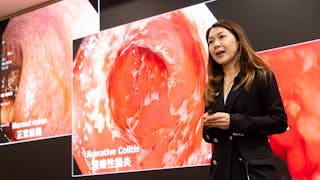 巨痛令《異形》編劇寫出爆肚產獸  中大：炎症性腸病30年增30倍、料醫療負擔年逾四億