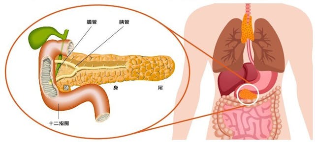 位在腹腔深處的胰臟，與胃、十二指腸、空腸、膽道、脾等都有關連，使相關疾病的手術相對困難。