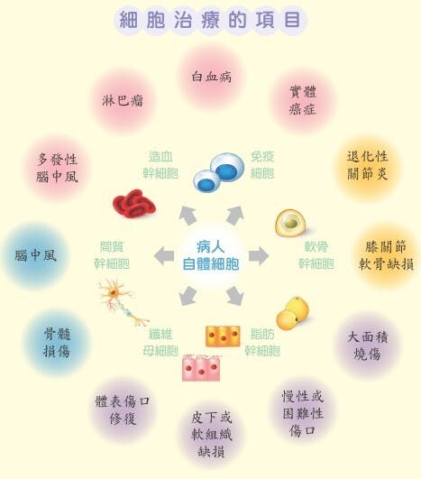 目前細胞治療的運用很廣，包括治療癌症、退化性關節炎、膝關節軟骨缺損、骨髓損傷等。（引用自花蓮慈院新書《年過四十，打造熟齡A+健康力》）