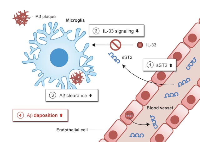 上圖顯示在AD患者大腦中，高濃度sST2是如何抑制小膠質細胞清除A&beta;的功能：血液中的 sST2蛋白進入大腦(1)。sST2作為誘餌受體，可以與IL-33結合，阻斷小膠質細胞中正常的IL-33信號傳導(2)，從而降低小膠質細胞清除A&beta;的能力(3)，導致A&beta;斑塊聚集(4)。